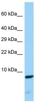 Host: Rabbit; Target Name: CDC42SE2; Sample Tissue: COLO205 Whole Cell lysates; Antibody Dilution: 1.0ug/ml