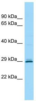 WB Suggested Anti-CEMP1 Antibody; Titration: 1.0 ug/ml; Positive Control: Hela Whole cell