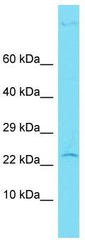 Host: Rabbit; Target Name: CENPBD1; Sample Tissue: Hela Whole Cell lysates; Antibody Dilution: 1.0 ug/ml