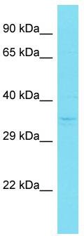 Host: Rabbit; Target Name: CENPL; Sample Tissue: Jurkat Whole Cell lysates; Antibody Dilution: 1.0 ug/ml