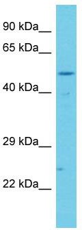 Host: Rabbit; Target Name: CCDC41; Sample Tissue: Jurkat Whole Cell lysates; Antibody Dilution: 1.0ug/mlCCDC41 is supported by BioGPS gene expression data to be expressed in Jurkat
