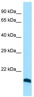 Host: Rabbit; Target Name: CLEC3A; Sample Tissue: HepG2 Whole Cell lysates; Antibody Dilution: 1.0 ug/ml