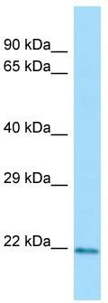 WB Suggested Anti-CLEC3A Antibody; Titration: 1.0 ug/ml; Positive Control: 293T Whole Cell