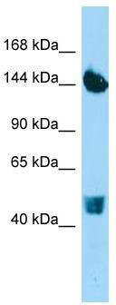 Host: Rabbit; Target Name: COL22A1; Sample Tissue: HepG2 Whole Cell lysates; Antibody Dilution: 1.0ug/ml
