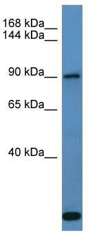 Host: Rabbit; Target Name: COL27A1; Sample Tissue: Fetal Lung lysates; Antibody Dilution: 1.0 ug/ml