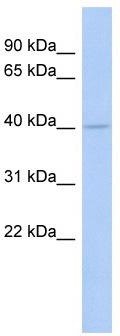 WB Suggested Anti-COQ2 Antibody Titration: 0.2-1 ug/ml; ELISA Titer: 1: 12500; Positive Control: DU145 cell lysate COQ2 is supported by BioGPS gene expression data to be expressed in DU145