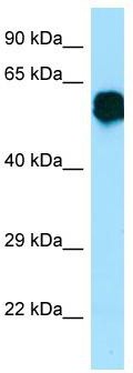 WB Suggested Anti-CR1L Antibody; Titration: 1.0 ug/ml; Positive Control: Fetal Brain