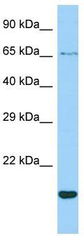 Host: Rabbit; Target Name: CR1L; Sample Tissue: ACHN Whole cell lysates; Antibody Dilution: 1.0 ug/ml