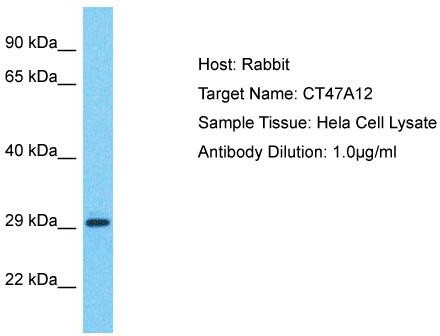 Host: Rabbit; Target Name: CT47A12; Sample Tissue: Hela Whole Cell lysates; Antibody Dilution: 1.0ug/ml