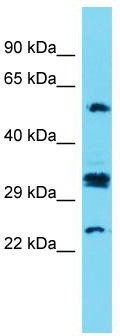 Host: Rabbit; Target Name: CT47A7; Sample Tissue: Fetal Kidney lysates; Antibody Dilution: 1.0 ug/ml