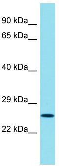 Host: Rabbit; Target Name: CXorf48; Sample Tissue: HT1080 Whole Cell lysates; Antibody Dilution: 1.0 ug/ml. CXorf48 is supported by BioGPS gene expression data to be expressed in HT1080