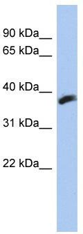 WB Suggested Anti-CYB5RL Antibody Titration: 0.2-1 ug/ml; ELISA Titer: 1:1562500; Positive Control: HT1080 cell lysate