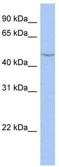 WB Suggested Anti-CYP27C1 Antibody Titration: 0.2-1 ug/ml; ELISA Titer: 1: 12500; Positive Control: HT1080 cell lysate