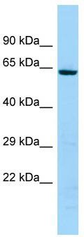 WB Suggested Anti-KRT74 Antibody; Titration: 1.0 ug/ml; Positive Control: 721_B Whole Cell
