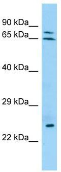 WB Suggested Anti-KRT74 Antibody; Titration: 1.0 ug/ml; Positive Control: Jurkat Whole Cell