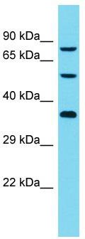 Host: Rabbit; Target Name: DCAF8L2; Sample Tissue: Jurkat Whole Cell lysates; Antibody Dilution: 1.0 ug/ml