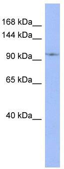 WB Suggested Anti-DDX26B Antibody Titration: 0.2-1 ug/ml; ELISA Titer: 1:62500; Positive Control: THP-1 cell lysate