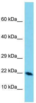 Host: Rabbit; Target Name: DEFB129; Sample Tissue: Esophagus Tumor lysates; Antibody Dilution: 1.0 ug/ml