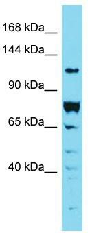 Host: Rabbit; Target Name: DENND2A; Sample Tissue: 293T Whole Cell lysates; Antibody Dilution: 1.0 ug/ml