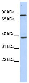 WB Suggested Anti-DHX35 Antibody Titration: 0.2-1 ug/ml; ELISA Titer: 1:312500; Positive Control: Human heart