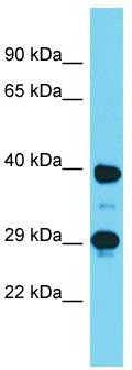 Host: Rabbit; Target Name: Dmrtc2; Sample Tissue: Mouse Stomach lysates; Antibody Dilution: 1.0ug/ml