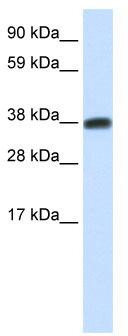 WB Suggested Anti-DMRTC2 Antibody Titration: 0.2-1 ug/ml; ELISA Titer: 1:62500; Positive Control: Human Testis