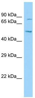 Host: Rabbit; Target Name: DNAH12; Sample Tissue: Hela Whole cell lysates; Antibody Dilution: 1.0ug/ml