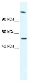WB Suggested Anti-HELB Antibody Titration: 2.5 ug/ml; ELISA Titer: 1:62500; Positive Control: Jurkat cell lysate