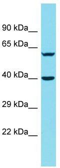 Host: Rabbit; Target Name: DNAJB14; Sample Tissue: 721_B Whole Cell lysates; Antibody Dilution: 1.0 ug/mlDNAJB14 is supported by BioGPS gene expression data to be expressed in 721_B