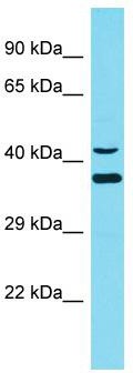Host: Rabbit; Target Name: DNAJC18; Sample Tissue: 293T Whole Cell lysates; Antibody Dilution: 1.0 ug/ml