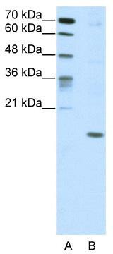 WB Suggested Anti-DUX5 Antibody Titration: 5.0 ug/ml; ELISA Titer: 1: 12500; Positive Control: HepG2 cell lysate