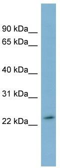 WB Suggested Anti-DUXA Antibody Titration: 0.2-1 ug/ml; Positive Control: Human Stomach