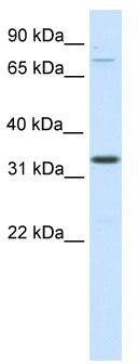 WB Suggested Anti-Duxbl Antibody Titration: 0.125ug/ml; ELISA Titer: 1:1562500; Positive Control: SP2/0 cell lysate