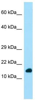 WB Suggested Anti-DYNLRB1 Antibody; Titration: 1.0 ug/ml; Positive Control: Fetal Heart