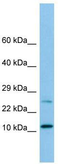 WB Suggested Anti-DYNLRB1 Antibody; Titration: 1.0 ug/ml; Positive Control: Hela Whole Cell DYNLRB1 is strongly supported by BioGPS gene expression data to be expressed in Human HeLa cells