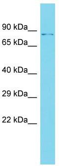 Host: Rabbit; Target Name: DZANK1; Sample Tissue: OVCAR-3 Whole Cell lysates; Antibody Dilution: 1.0ug/ml