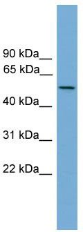 WB Suggested Anti-EFCAB3 Antibody Titration: 0.2-1 ug/ml; ELISA Titer: 1: 1562500; Positive Control: NCI-H226 cell lysate