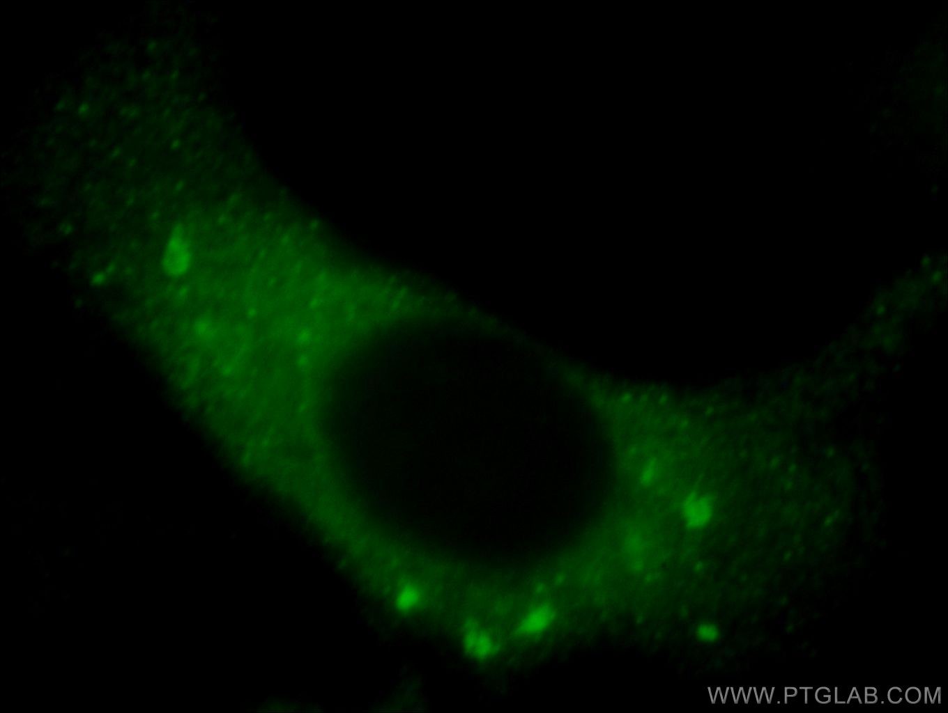 Immunofluorescent analysis of Hela cells, using C14orf133 antibody 20771-1-AP at 1:25 dilution and FITC- labeled FITC-Donkey anti-Rabbit IgG (green).
