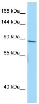 Host: Rabbit; Target Name: NBPF10; Sample Tissue: HepG2 Whole Cell lysates; Antibody Dilution: 1.0 ug/ml