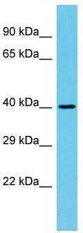 Host: Rabbit; Target Name: C17orf85; Sample Tissue: Fetal Kidney lysates; Antibody Dilution: 1.0ug/ml