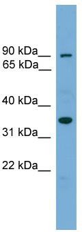 WB Suggested Anti-NDNL2 Antibody Titration: 0.2-1 ug/ml; Positive Control: Human brain