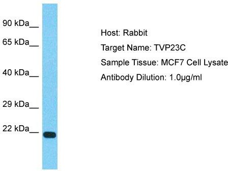 Host: Rabbit; Target Name: TVP23C; Sample Tissue: MCF7 Whole Cell lysates; Antibody Dilution: 1.0ug/ml