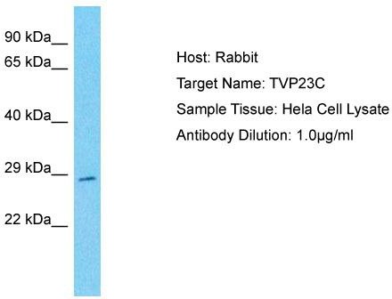 Host: Rabbit; Target Name: TVP23C; Sample Tissue: Hela Whole cell lysates; Antibody Dilution: 1.0 ug/ml