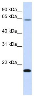 WB Suggested Anti-FAM19A3 Antibody Titration: 0.2-1 ug/ml; ELISA Titer: 1: 1562500; Positive Control: Human Liver