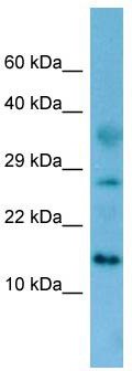 WB Suggested Anti-Fam19a4 Antibody; Titration: 1.0 ug/ml; Positive Control: Rat Kidney