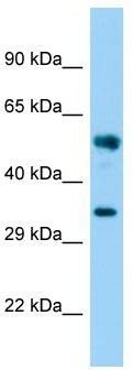 Host: Rabbit; Target Name: FAM49B; Sample Tissue: Fetal Brain lysates; Antibody Dilution: 1.0ug/ml