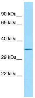 Host: Rabbit; Target Name: FAM49B; Sample Tissue: HT1080 Whole Cell lysates; Antibody Dilution: 1.0ug/ml