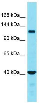 Host: Rabbit; Target Name: FAM65A; Sample Tissue: Placenta lysates; Antibody Dilution: 1.0 ug/ml