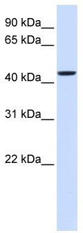 WB Suggested Anti-NIPA2 Antibody Titration: 0.2-1 ug/ml; ELISA Titer: 1: 312500; Positive Control: 293T cell lysate