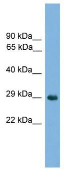 WB Suggested Anti-Nkx1-2 Antibody Titration: 0.2-1 ug/ml; ELISA Titer: 1:1562500; Positive Control: Mouse Lung